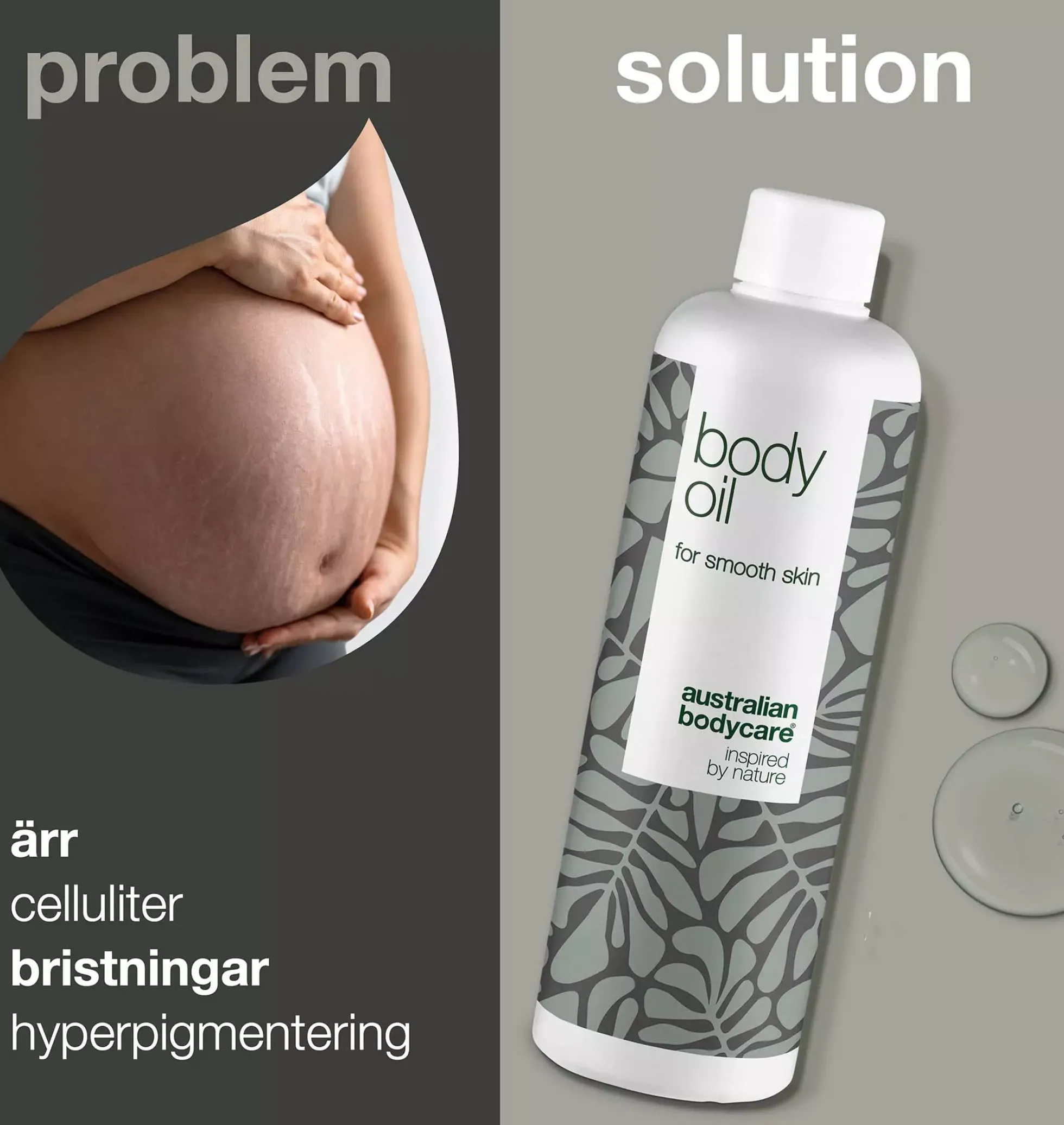 Australian Bodycare Body Oil 150 ml