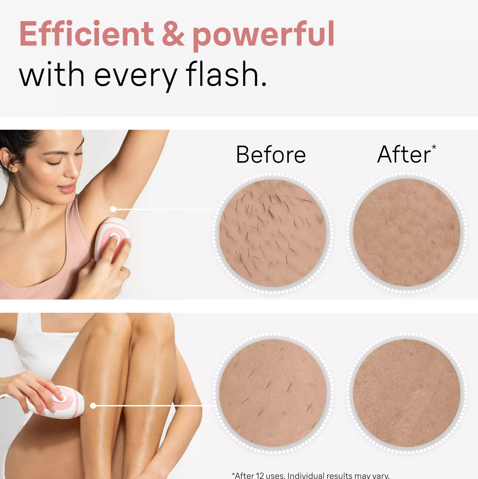 Braun IPL Silk·expert Mini PL1000 Latest Generation IPL