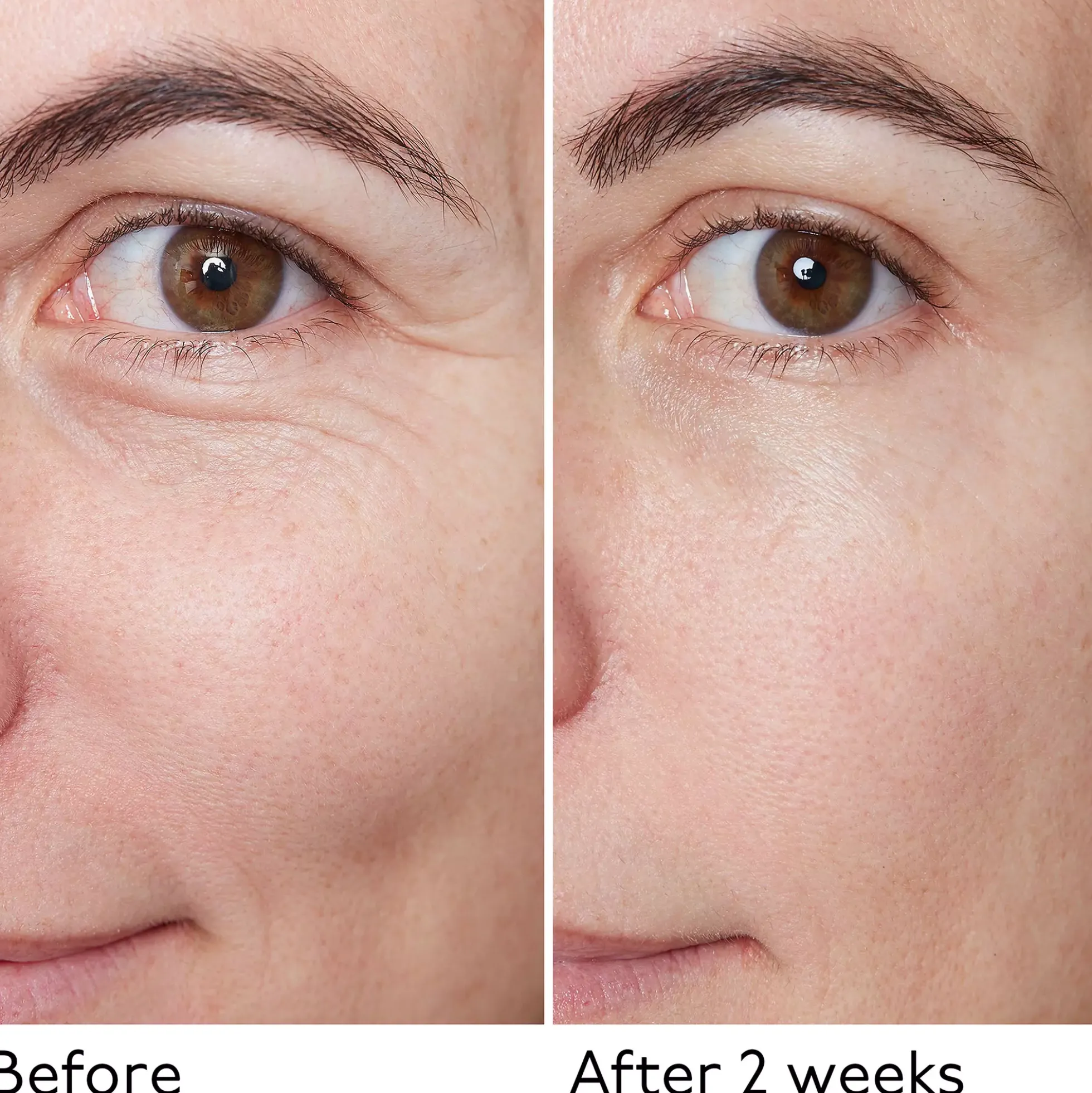 By Terry Hyaluronic Global Serum 30 ml
