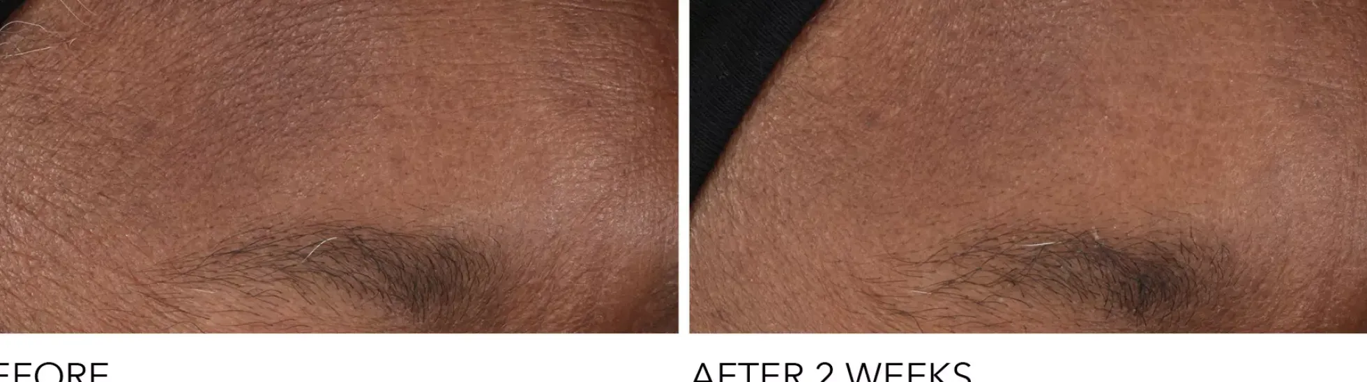 Dr Dennis Gross Advanced Retinol + Ferulic Overnight Wrinkle Treatment 30 ml