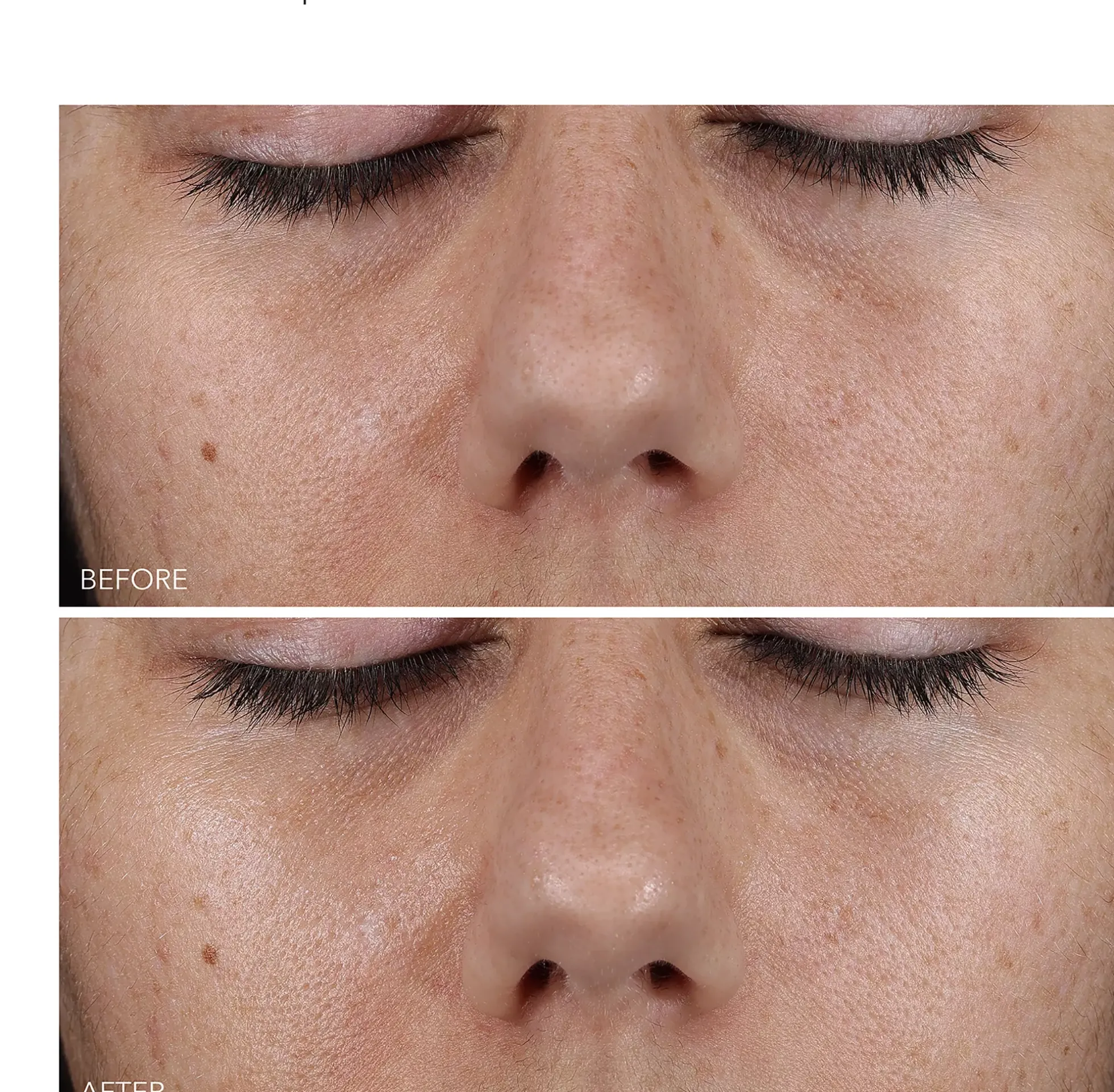 Dr Dennis GrossDermInfusions™ Blur + Repair Cream 50 st