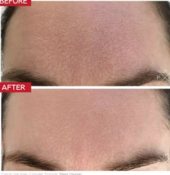 Dr. Levy 3Deep Cell Renewal Micro-Resurfacing Cleanser 150 ml