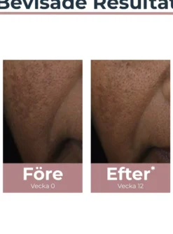 EucerinAnti-Pigment Spot Corrector 5 ml