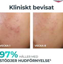 EucerinDermoPure Peeling 10 40 ml