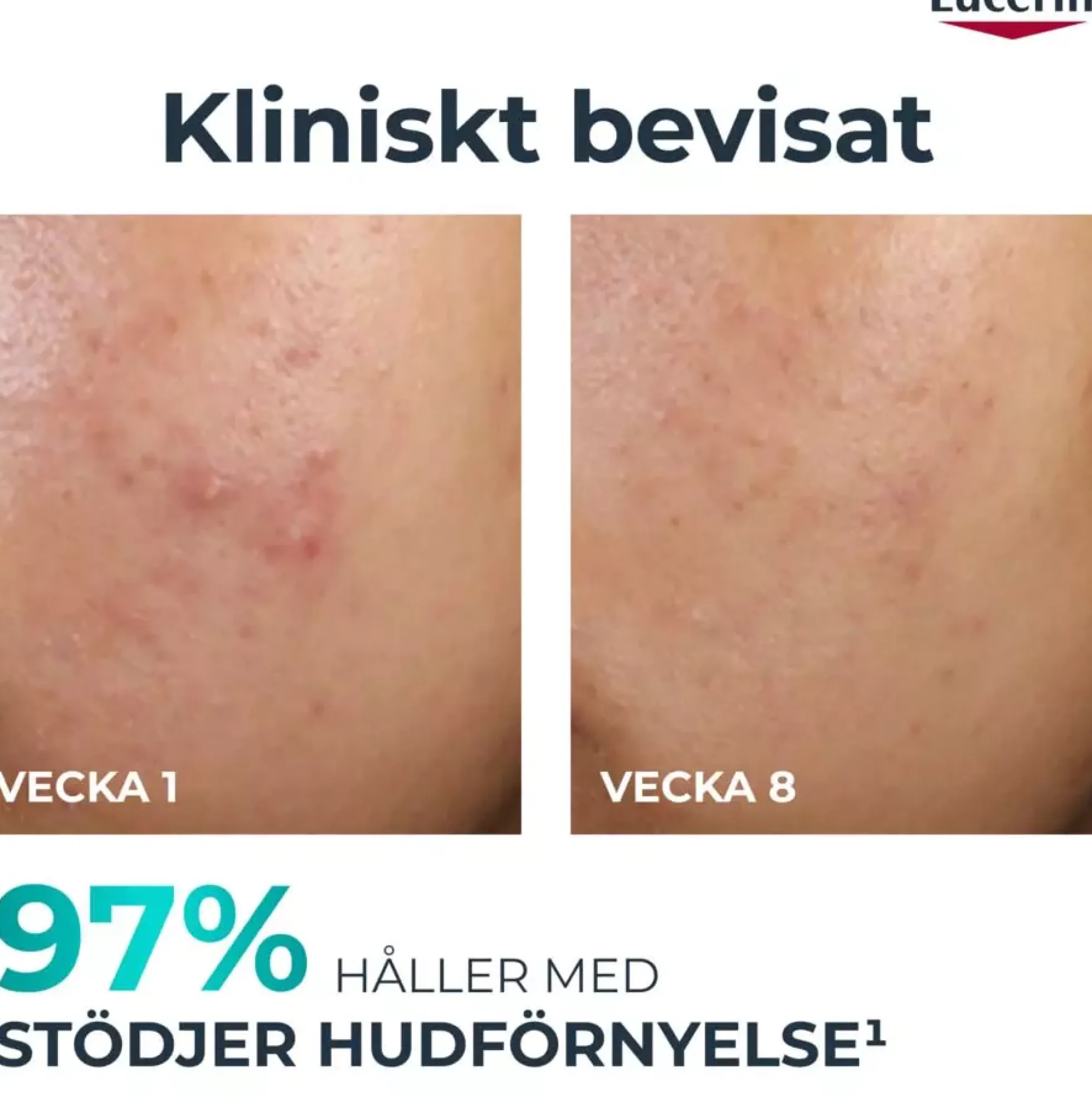 EucerinDermoPure Peeling 10 40 ml