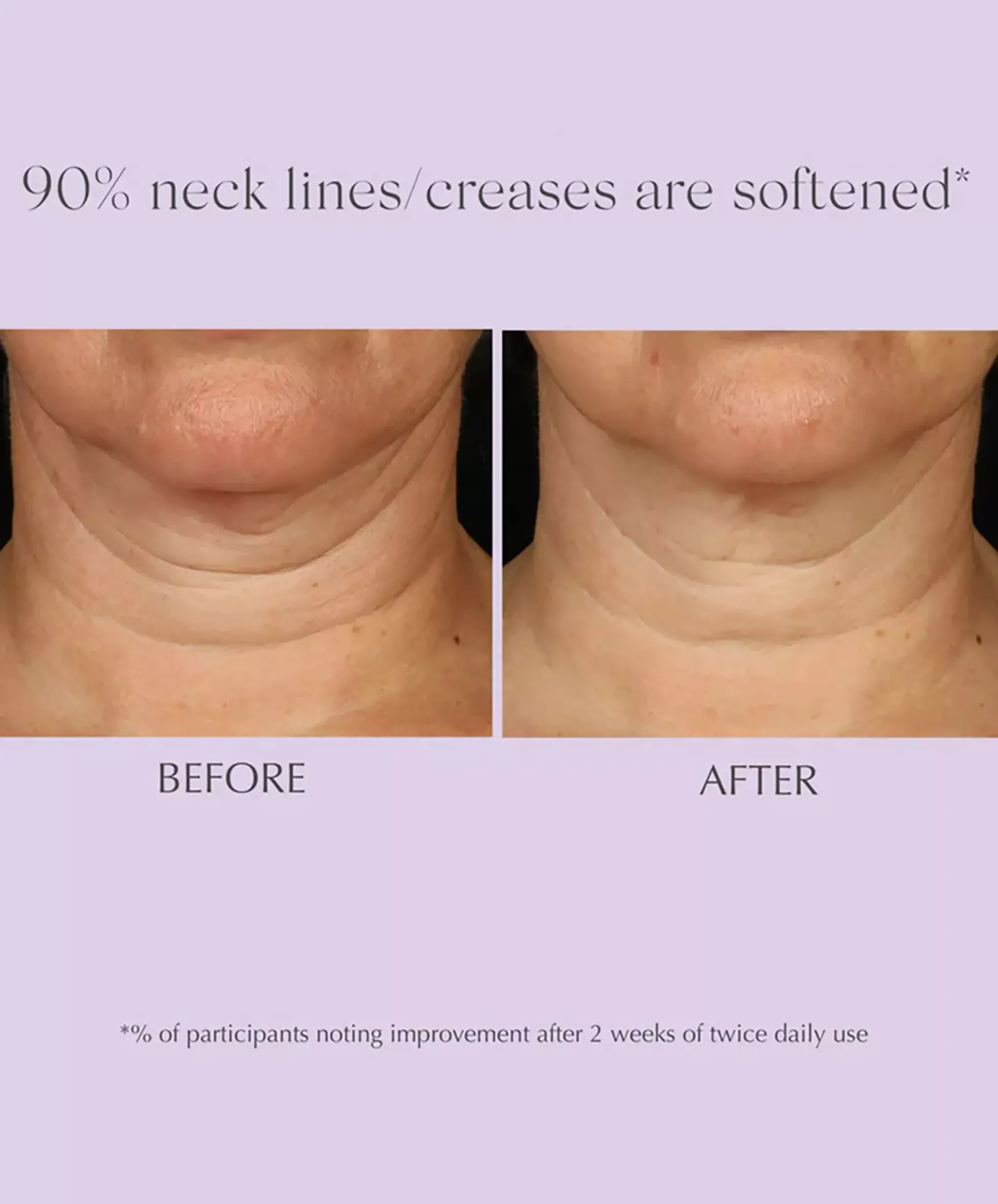Exuviance Age Reverse Toning Neck Cream 125 g
