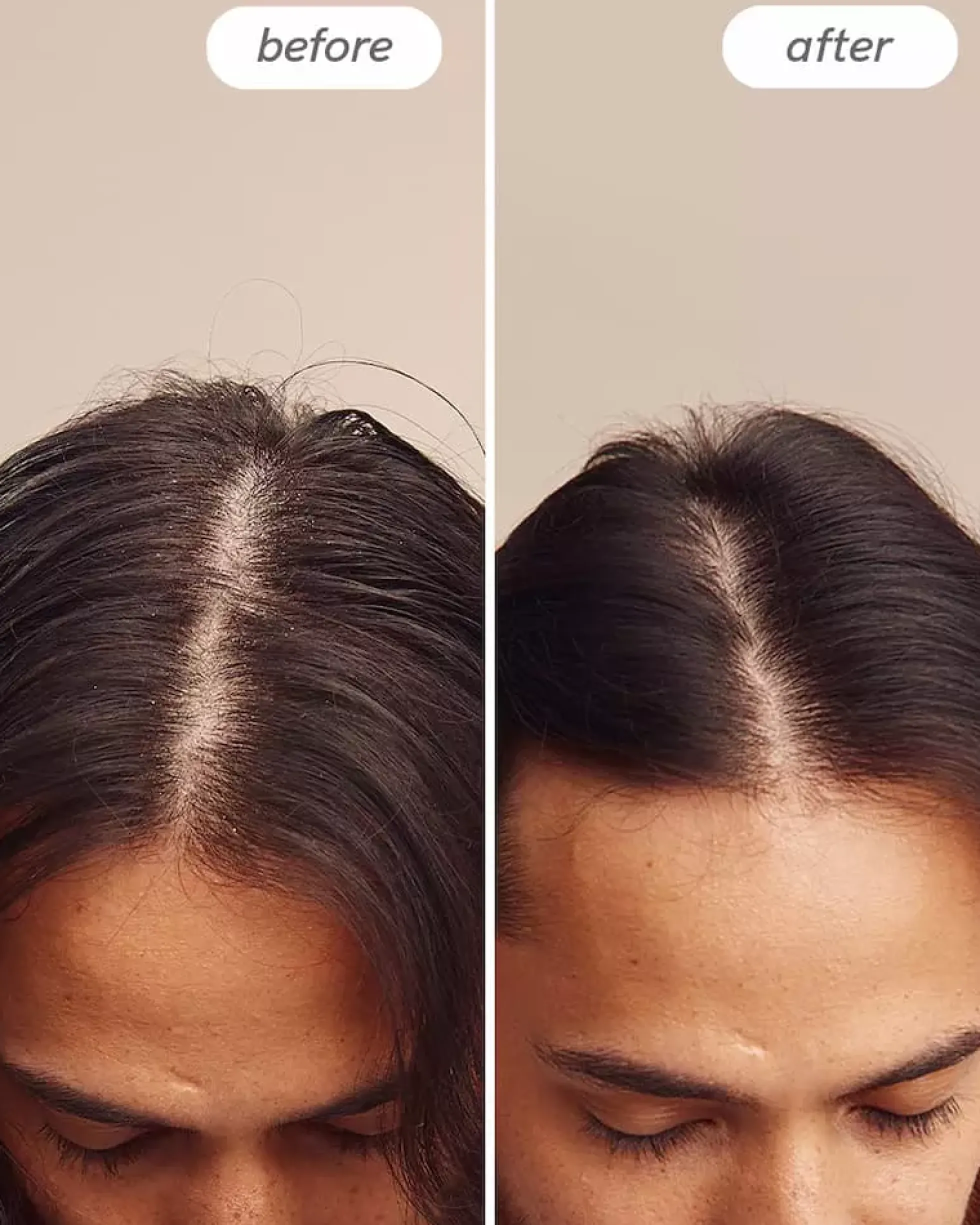 HairlustInstant Relief Scalp Spray 150 ml