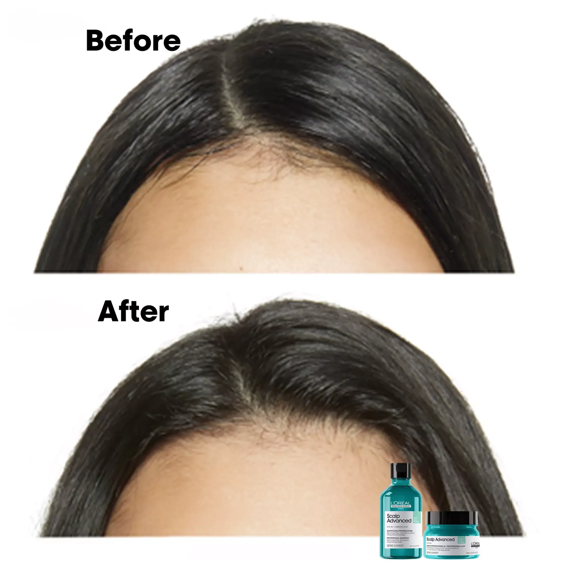 L'Oréal ProfessionnelScalp Advanced Professional Shampoo For Oily Scalp 300 ml
