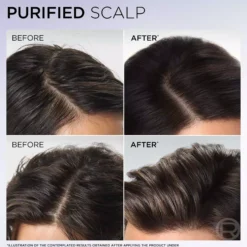 Loreal ParisElvital Hyaluron Pure Shampoo 250 ml