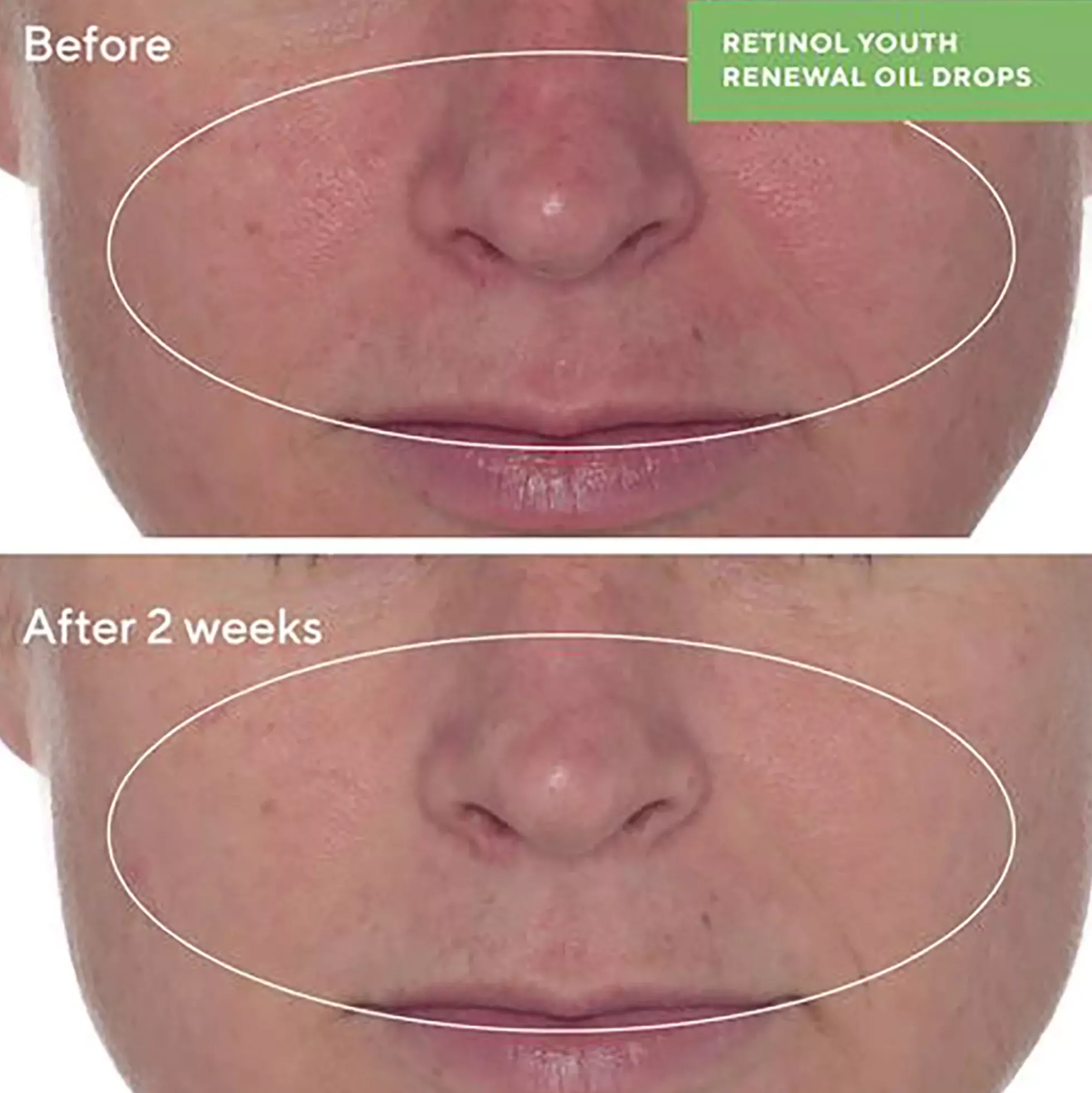 Murad Retinol Youth Renewal Oil Drops 30 ml