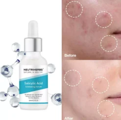 Neutriherbs Salicylic Acid Serum 30 ml