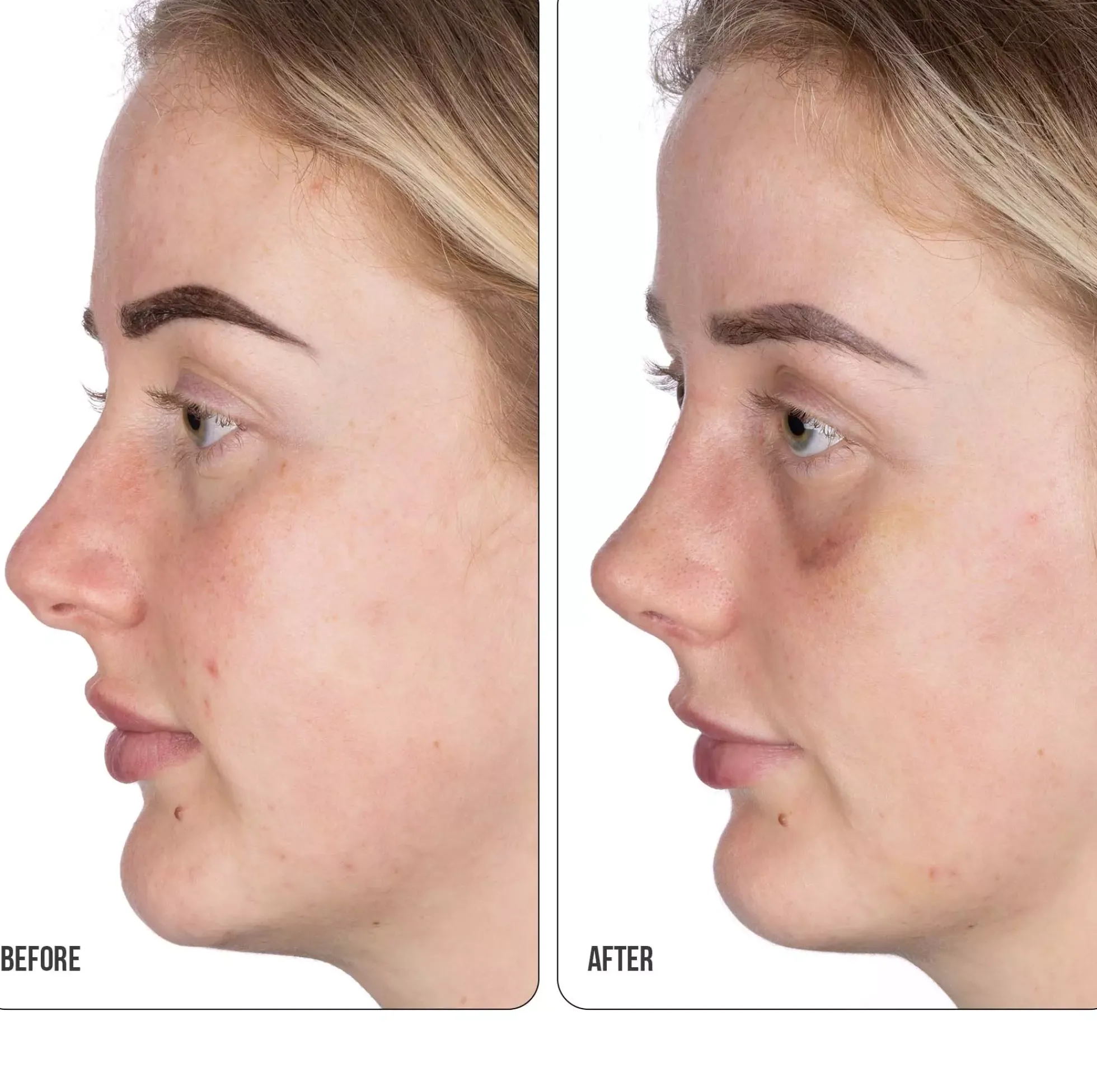NIP+FABRetinol Fix Retinol Fix Blemish Gel 15 ml