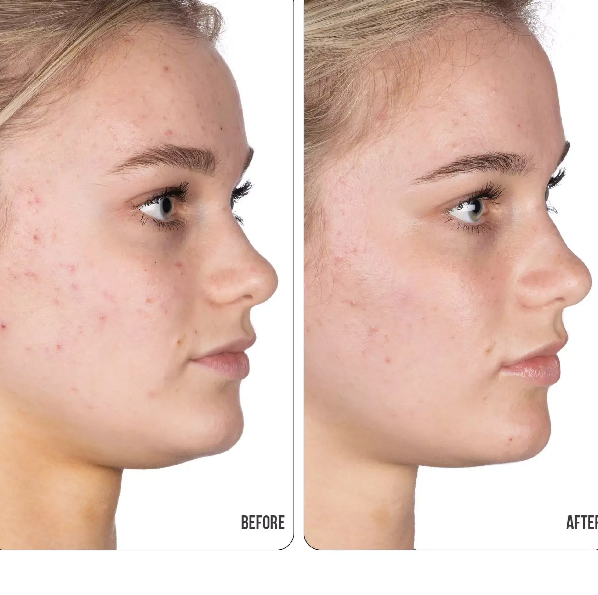 NIP+FABRetinol Fix Retinol Fix Blemish Gel 15 ml