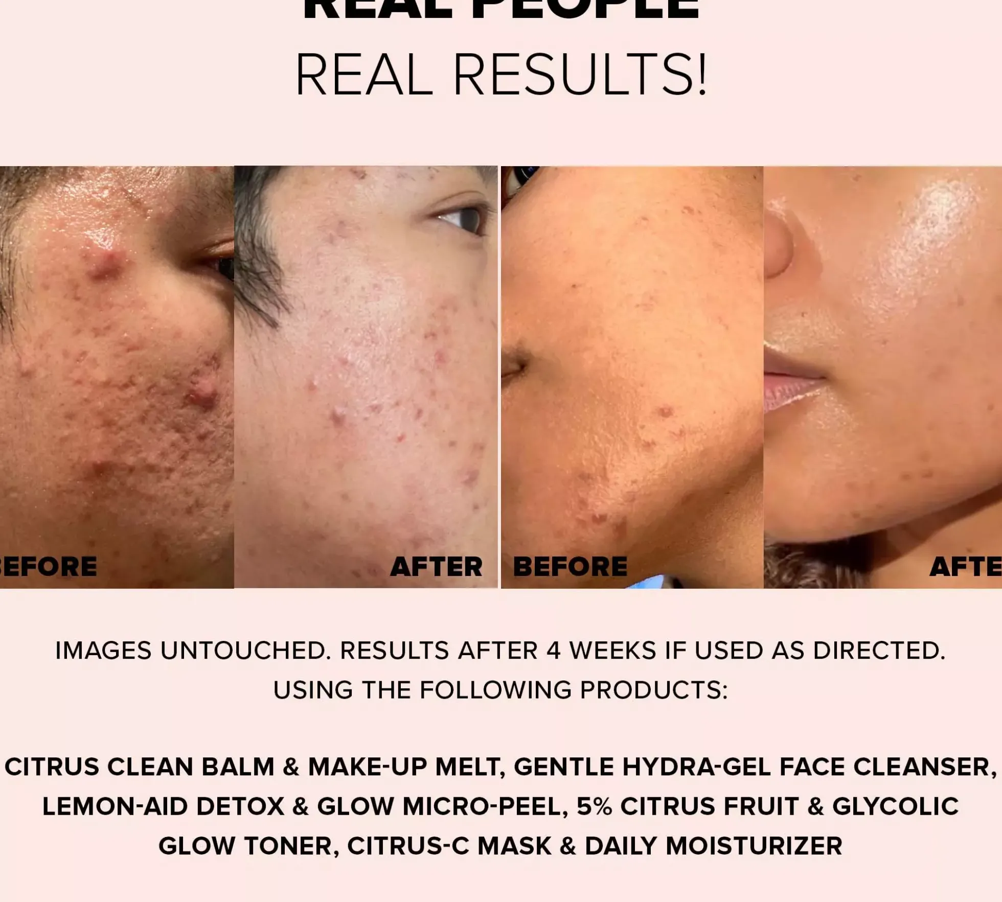 Nudestix Gentle Hydra-Gel Face Cleanser 70 ml