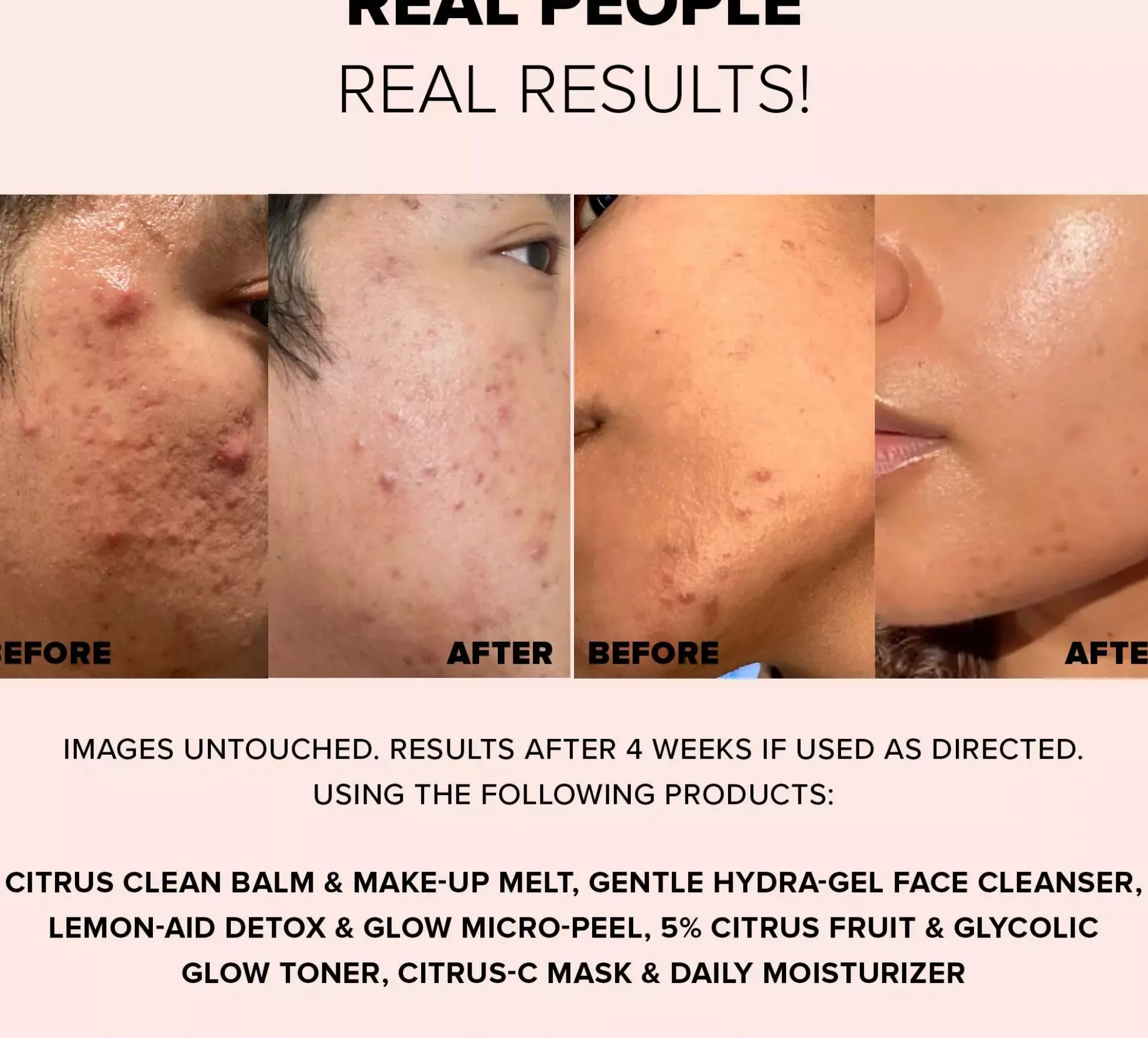 Nudestix 3-Step Citrus Skin Renewal - Makeup (Melt, Micro-peel, Moisturizer)