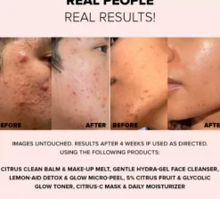 Nudestix 3-Step Citrus Skin Renewal - Sensitive (Cleanser, Micro-peel, Moisturizer)