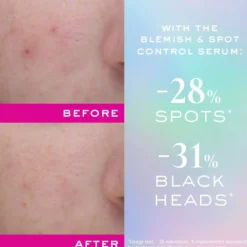 NuxeZinc Power Blemish And Spot Control Serum 30 ml
