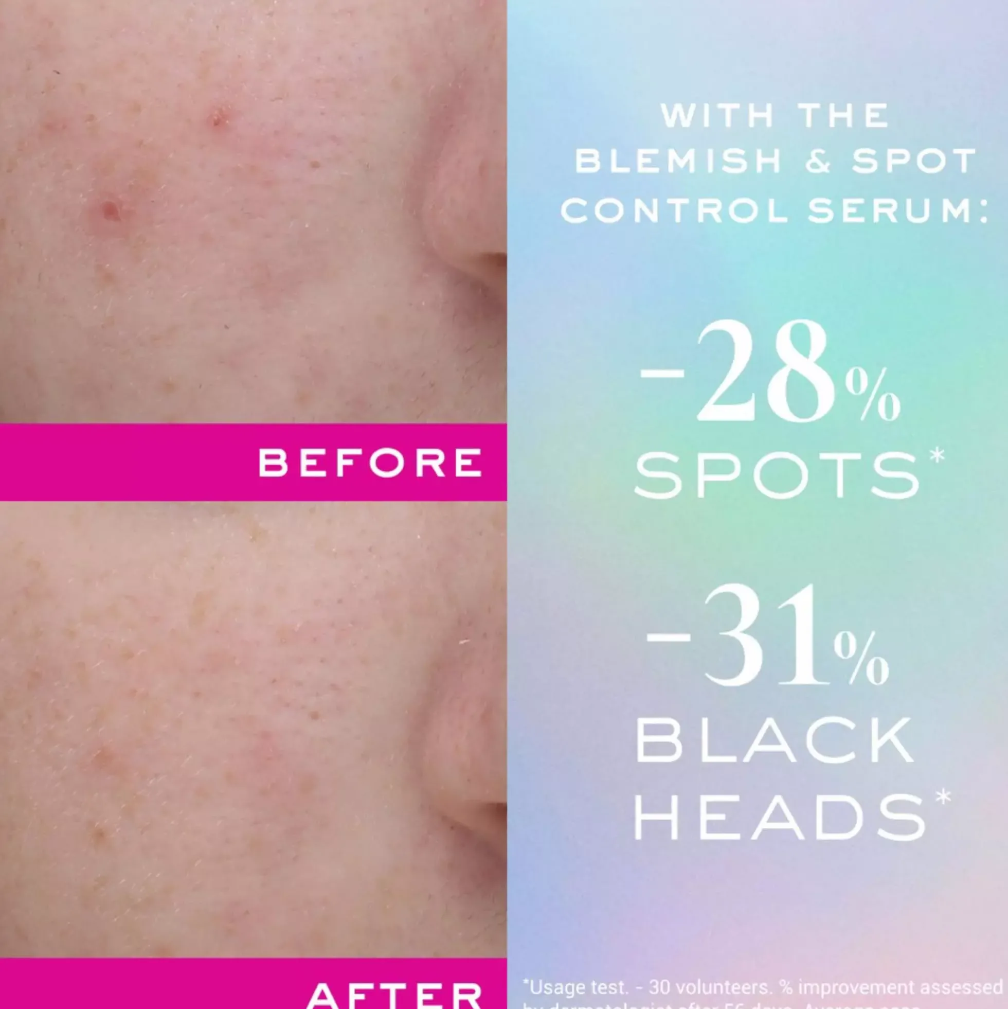 NuxeZinc Power Blemish And Spot Control Serum 30 ml