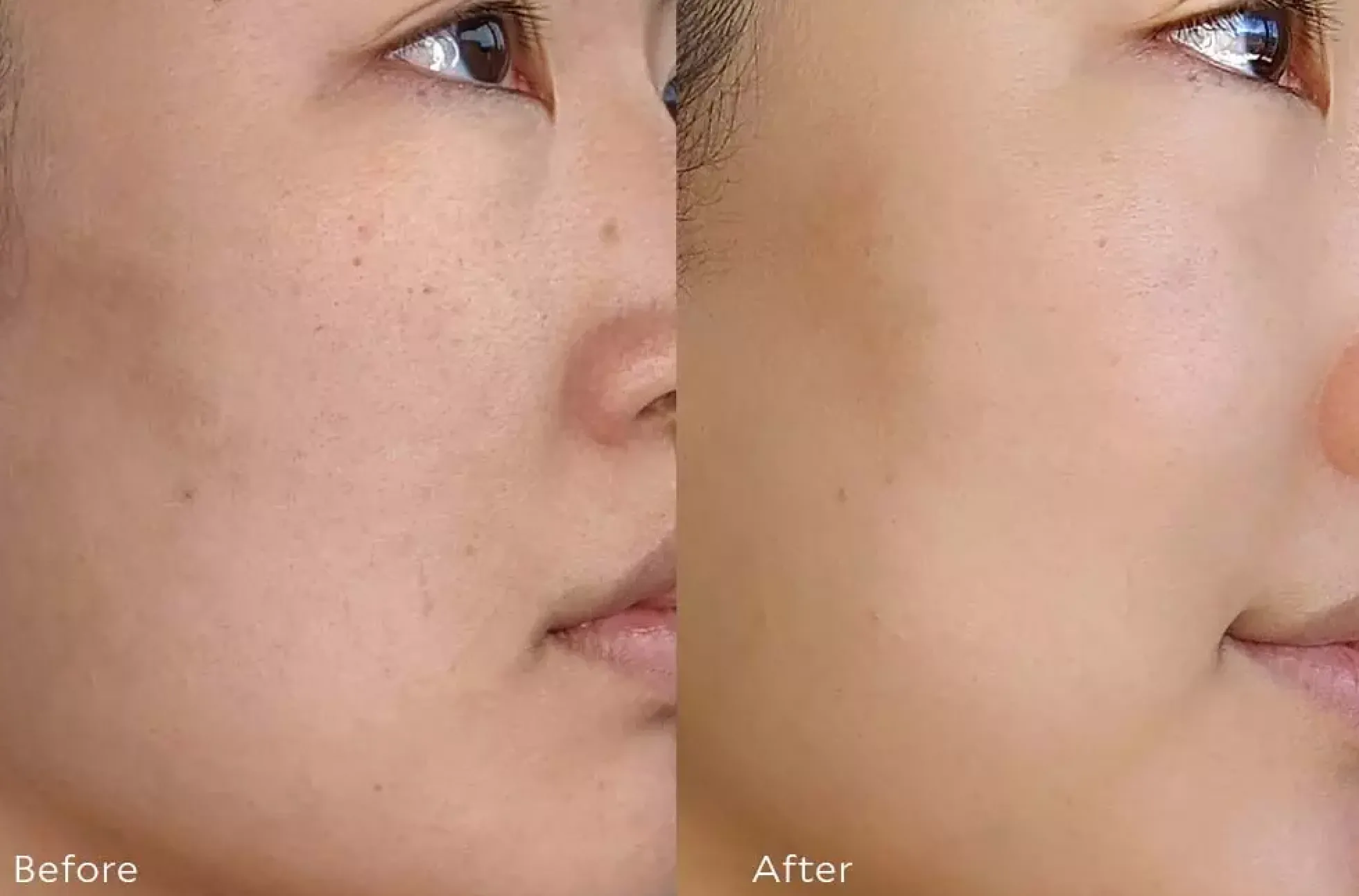 Tata Harper Resurfacing Serum 30 ml